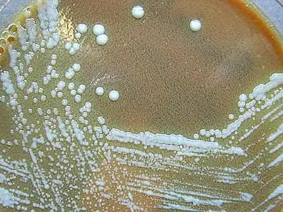 Another culture of Francisella tularensis