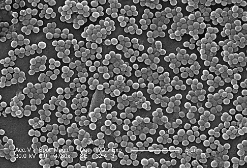 MRSA, a rare pathogen associated with some cases of vertebral osteomyelitis