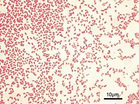 Gram-stained P. aeruginosa bacteria (pink-red rods)